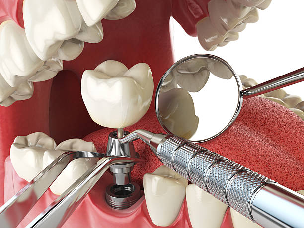 Best Emergency Treatment for Toothache in Schlusser, PA